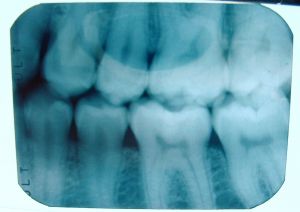 Brookhaven Dentist Near Me x-rays